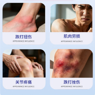 三田制药筋络透骨油外用保健液植物提取灵活关节疏通筋络舒缓疼痛|undefined