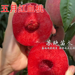 �޽����¼tѪ���Ҙ���5������Ѯ�����x�˼t������������Ѫ����