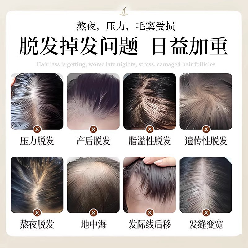 非严选-手工代熬云南侧柏叶洗发水养发润发去屑止痒控油洗发水|undefined