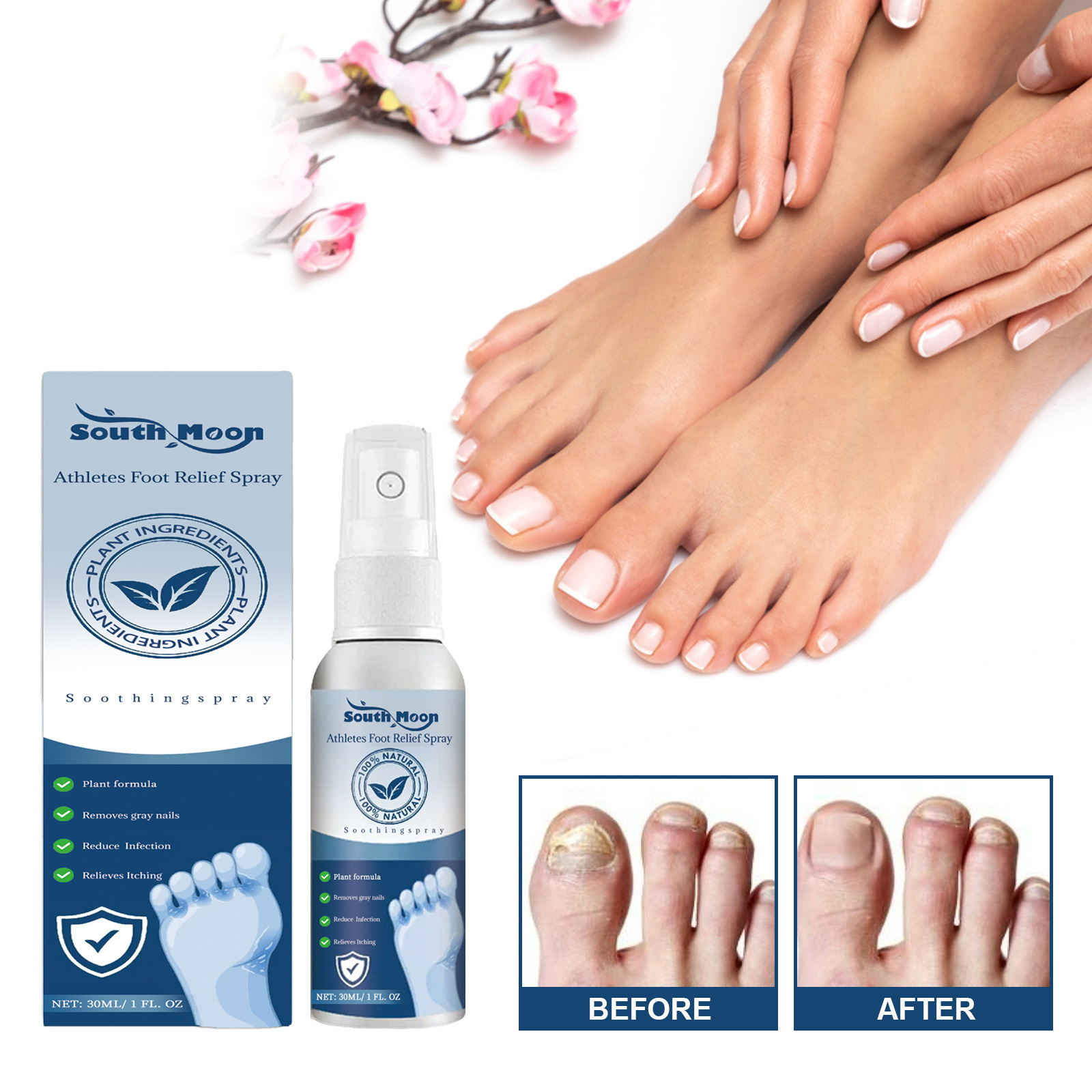 South Moon 足部喷雾 缓解脚汗脚痒脱皮灰指甲脚臭滋润清爽护理