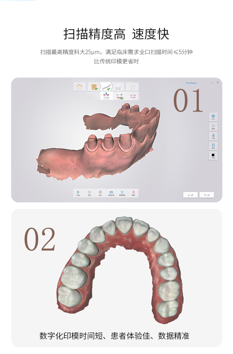 牙科口扫仪三维扫描仪口内3D数字化取模印模仪口腔诊所电脑一体机-阿里巴巴