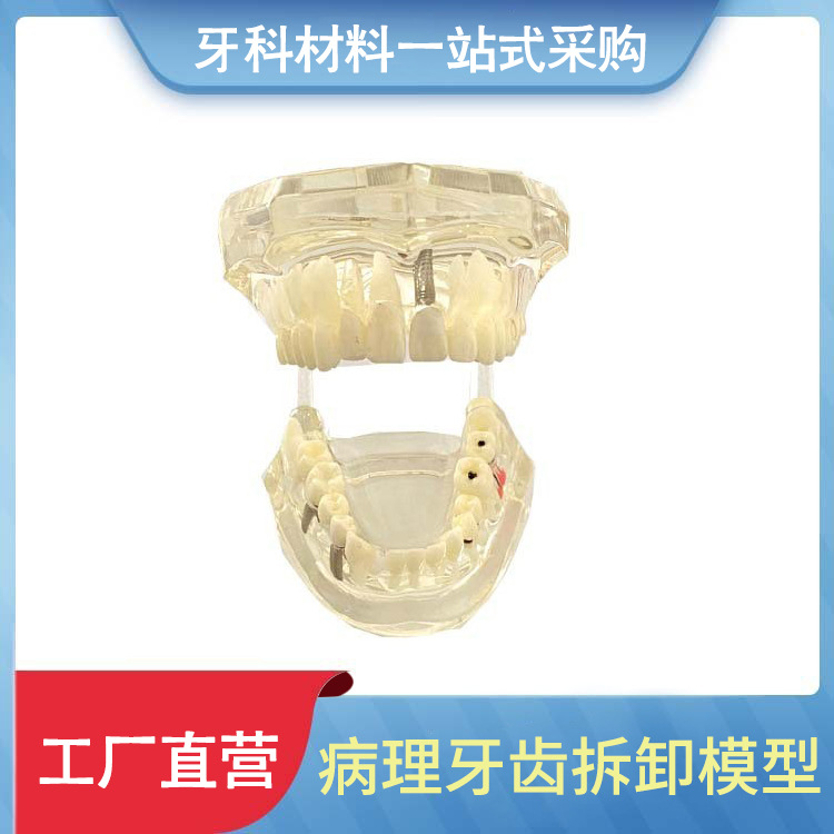 Modelo dental molde modelo dental modelo de enseñanza dental removible dentadura oral cepillado Preparación del diente modelo resina