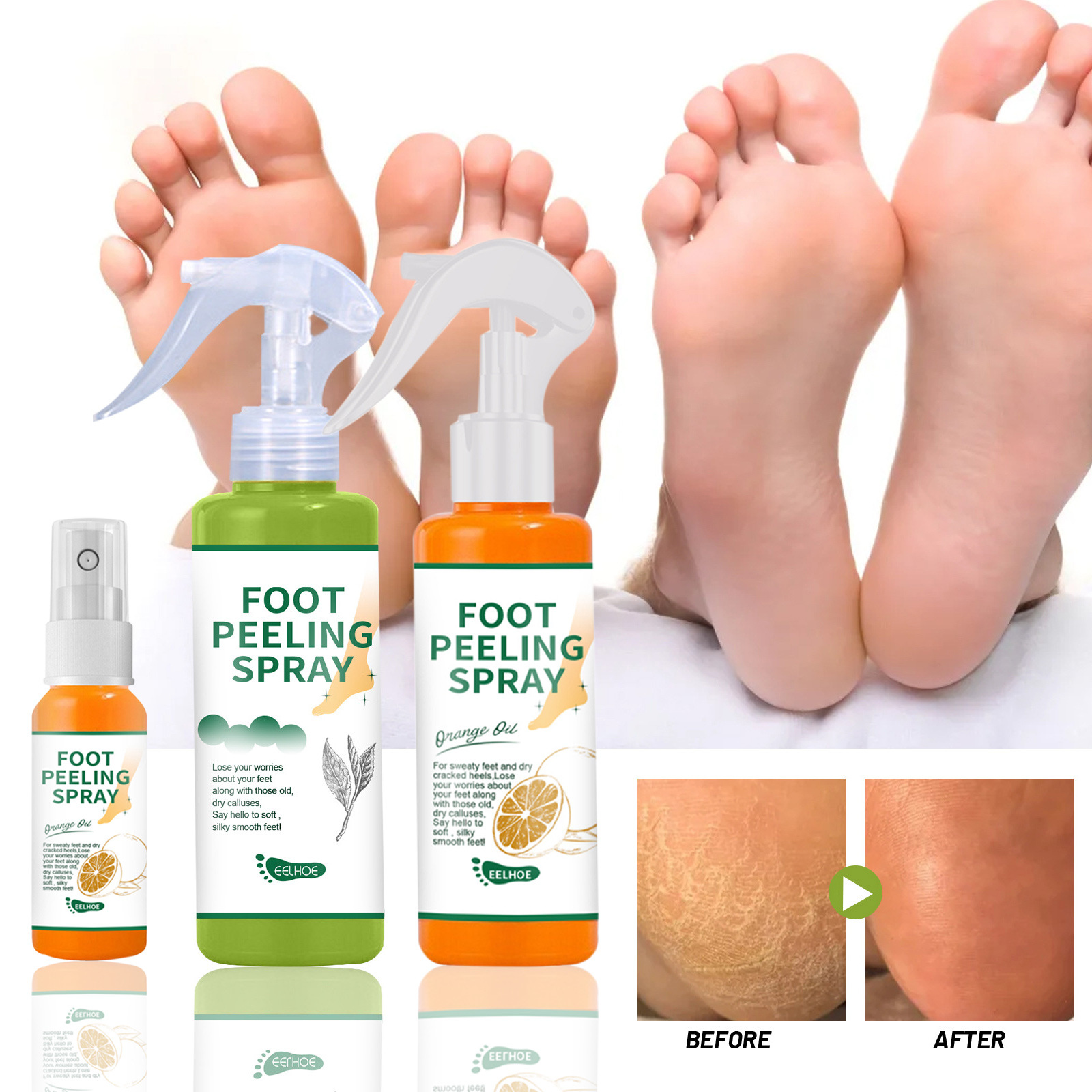 EELHOE Exfoliating Care Spray - Green Tea & Orange Flavor for Foot Corn, Heel, Elbow, and Knee Callus Removal