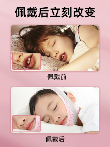 Oral breathing corrector for children to sleep, prevents mouth from opening, stops mouth from gaping, mouth seal band, closing mouth device