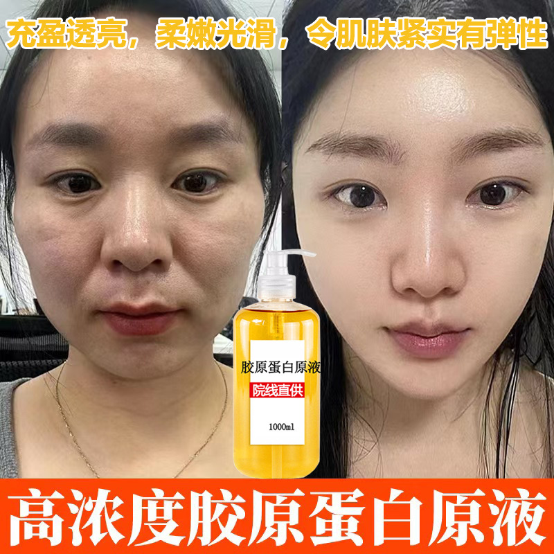 胶原蛋白三类重组原液抗皱精华液紧致提拉凹陷填充液保湿改善痘坑