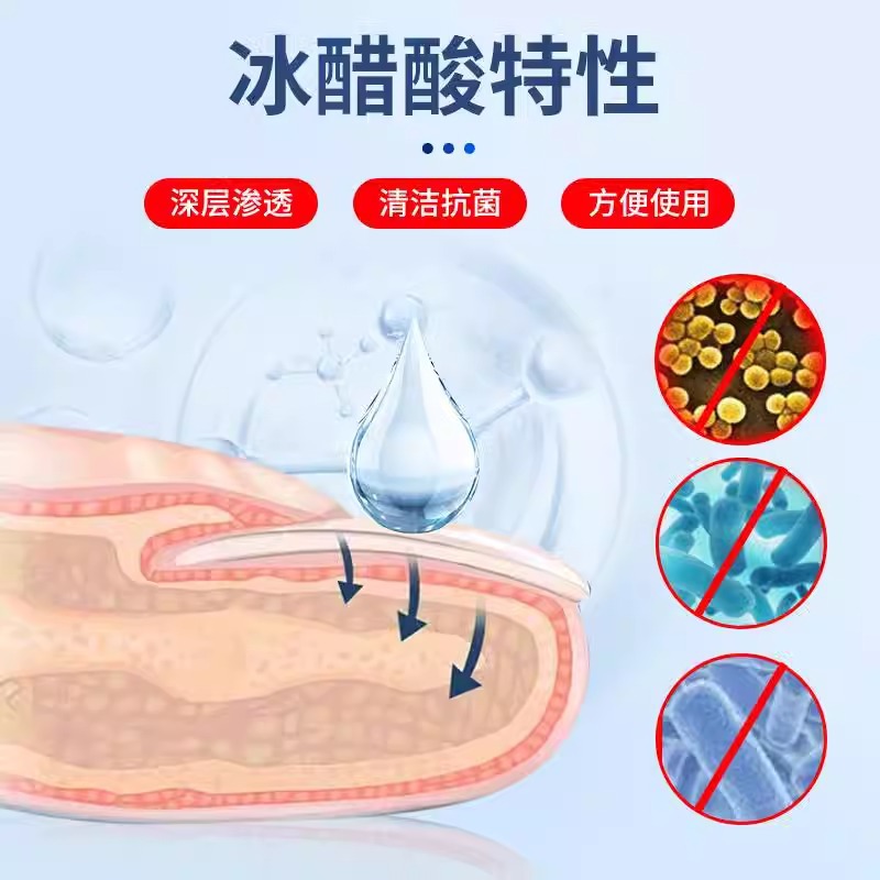 Haisi Hainuo 30% acetic acid diluted solution topical application agent antibacterial high concentration 3 foot bath coating agent 