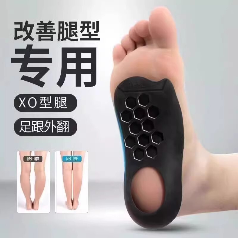 Arch support insoles for flat feet, XO-shaped leg and foot valgus corrector, support insoles for men and women, straight leg miracle device Arch support insoles for flat feet, XO-shaped leg and foot valgus corrector, support insoles for men and women, straight leg miracle device