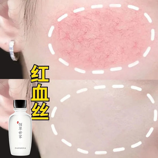 �۲����ҡ��tĘ�����ǡ�ȥ�tѪ�z��ԭ�t����Ę�ޏ����м����AҺ