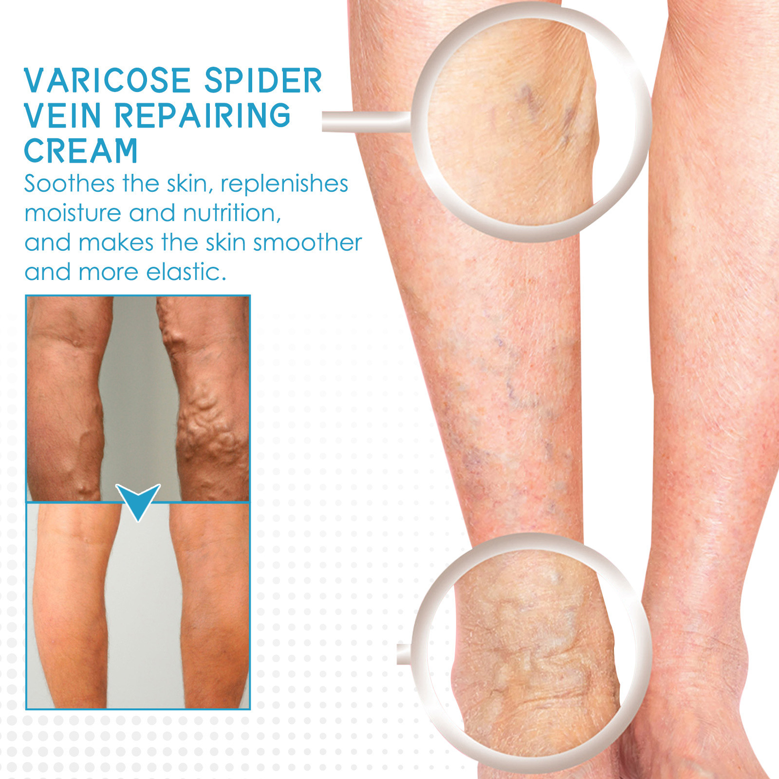 Lindert West&Month Repair Pain Regenwurm Bein prall gefüllte Venenpflege-Massagecreme_voghion.com