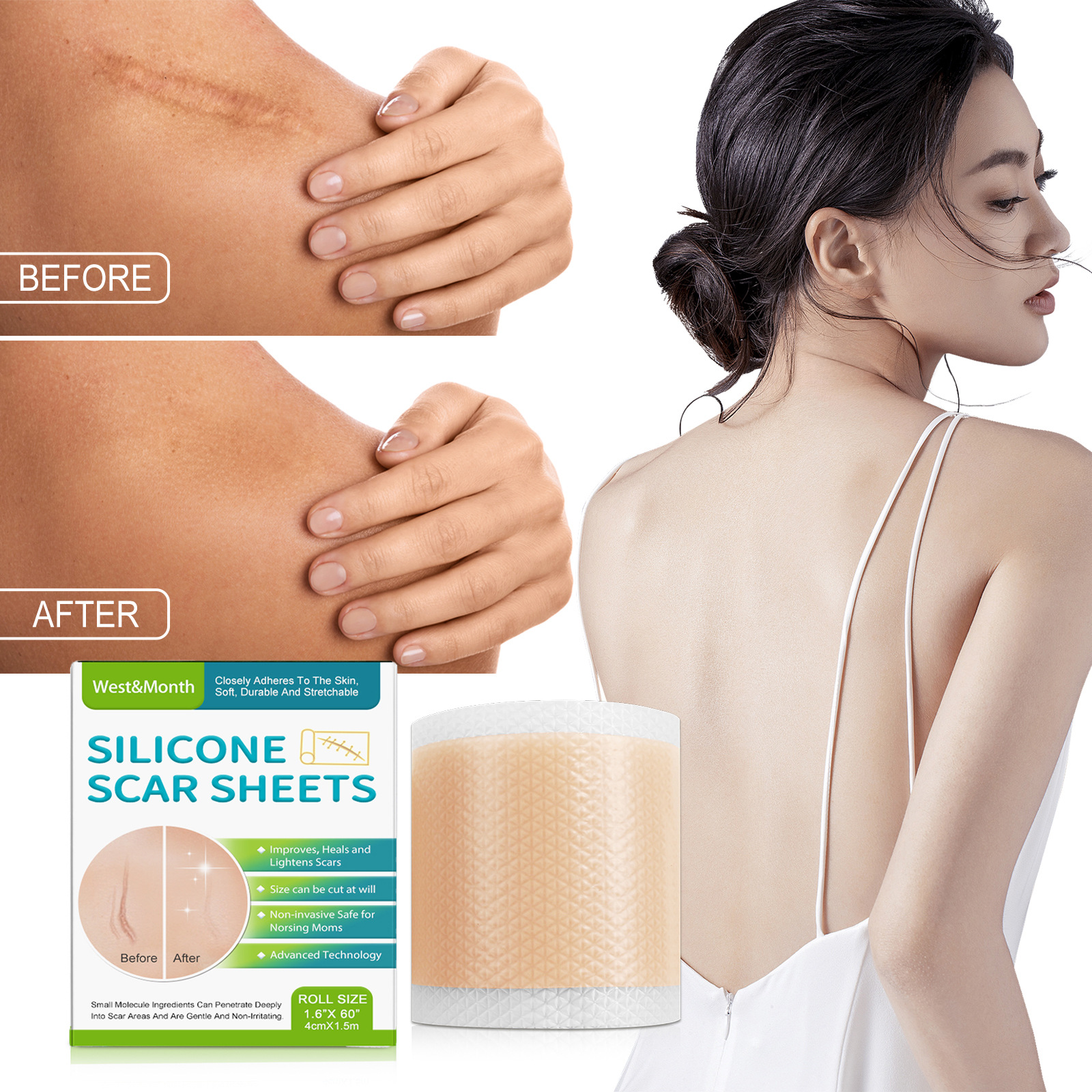 Self-adhesive Silicone Scar Paster Repair And Care Beauty Stickers