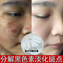 氨甲环酸乳膏去雀斑黄褐斑老年斑抑制黑色素传明酸美嫩白祛化斑霜
