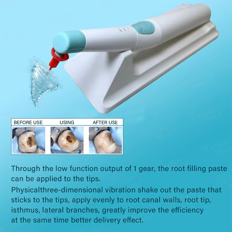Nuevo comercio exterior 3D Inalámbrico Dental Lápiz/máquina de lavado de tubo radicular punta de trabajo flexible ENDO ACTIVATOR