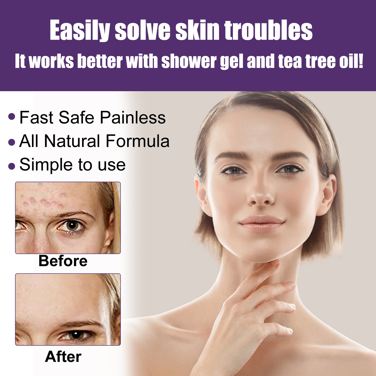 Skin Cleaning Removal of Underarm Hand and Foot Anti Wart Flat Care Liquid Set_voghion.com