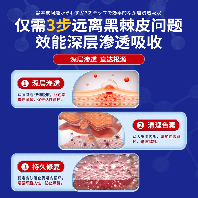 岩井昃弘去黑脖子黑色素沉淀症黑棘皮药膏脖颈关节黑肥胖洗不干净|undefined