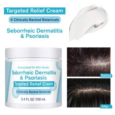 [跨境新品Seborrheic Dermatitis Cream皮肤护理霜滋润呵护肌肤]