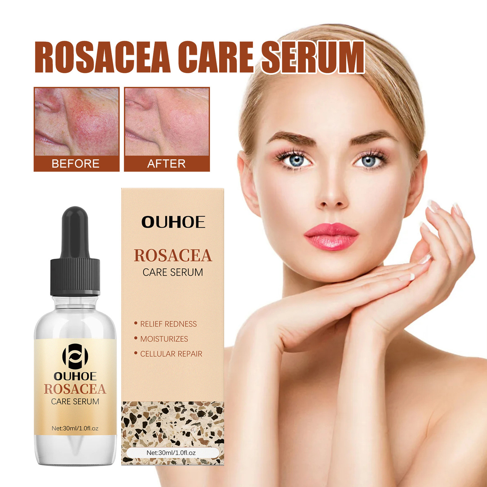 OUHOE Repair essence Repairs Skin Barrier, Lightens Facial Erythema Moisturizing Essential Oil_voghion.com