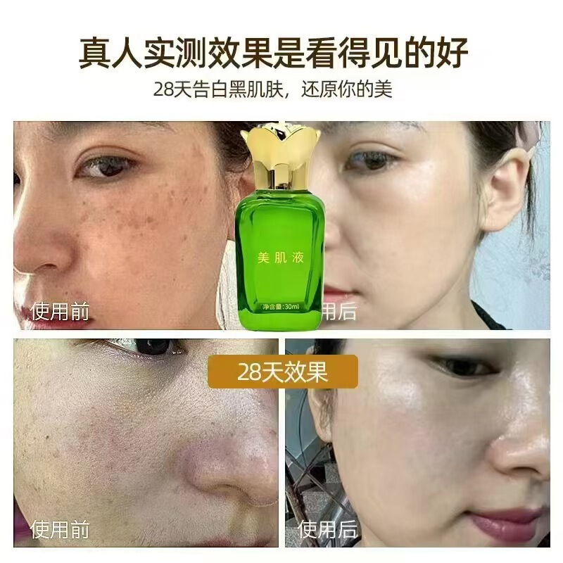 美容臭臭水疏基蛋白水亮肤液祛斑液美肌亮肤排铅排汞靓肤液无尴尬|undefined