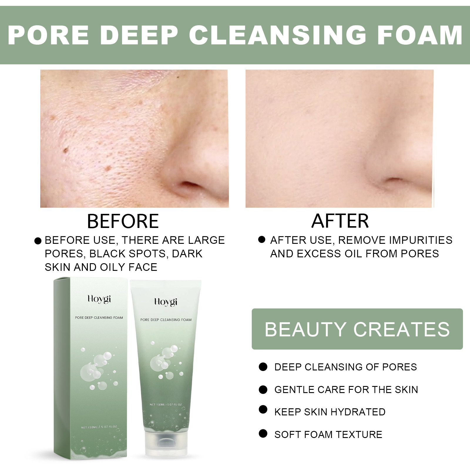 Le nettoyant nettoyant pour pores Hoygi illumine la peau du visage, nettoie en profondeur les marques d'acné, nettoie, hydrate et hydrate_voghion.com