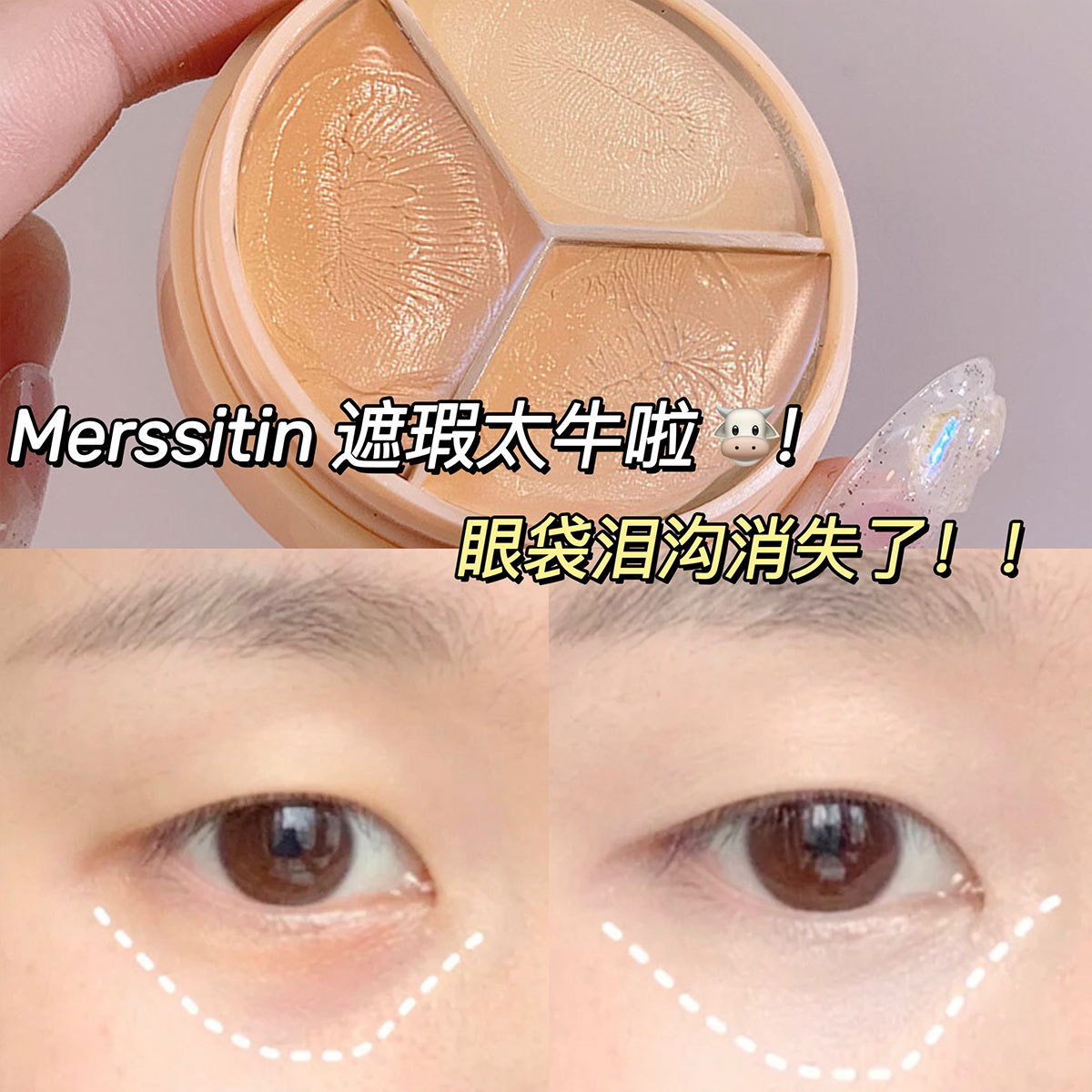 Mersitin tricolor concealer to cover spots, dark circles, lacrimal furrows, acne, facial freckles, magic tool concealer