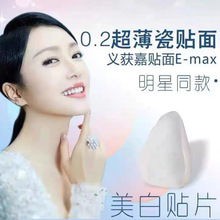全瓷牙齿贴面 义获嘉超薄牙贴进口贴片琥珀瓷贴面 冰瓷陶瓷牙贴面
