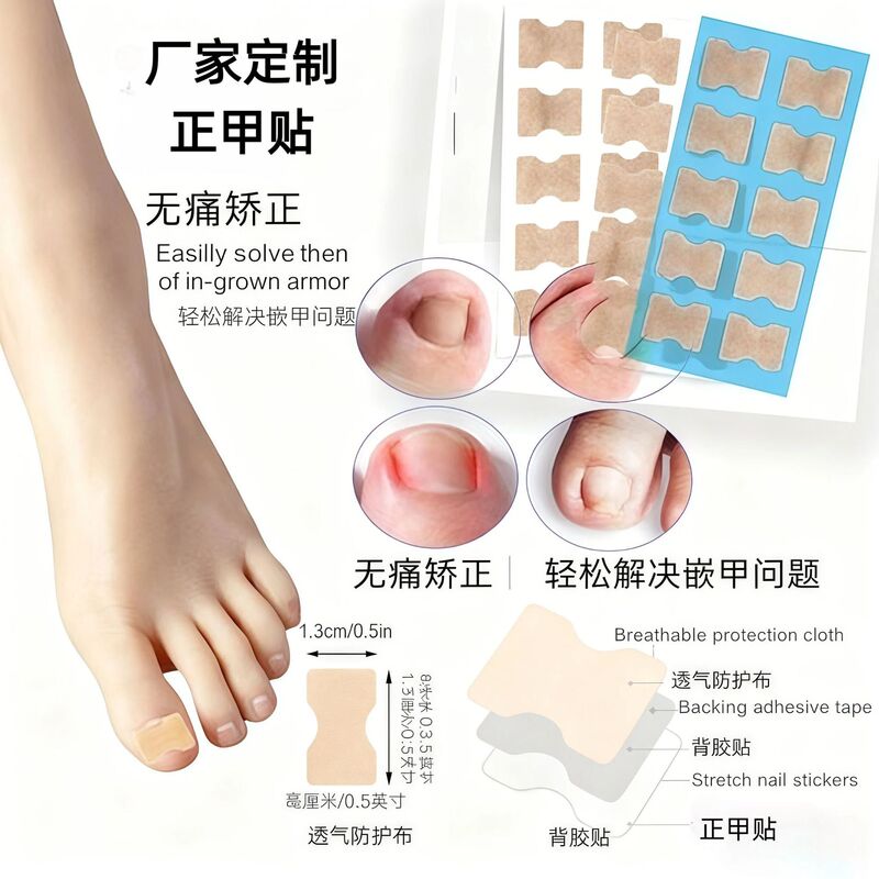 Manufacturer Customized Nail Correction Patch Cross-Border Spot Nail Correction Patch Toe Embedded Glue-Free Corrector