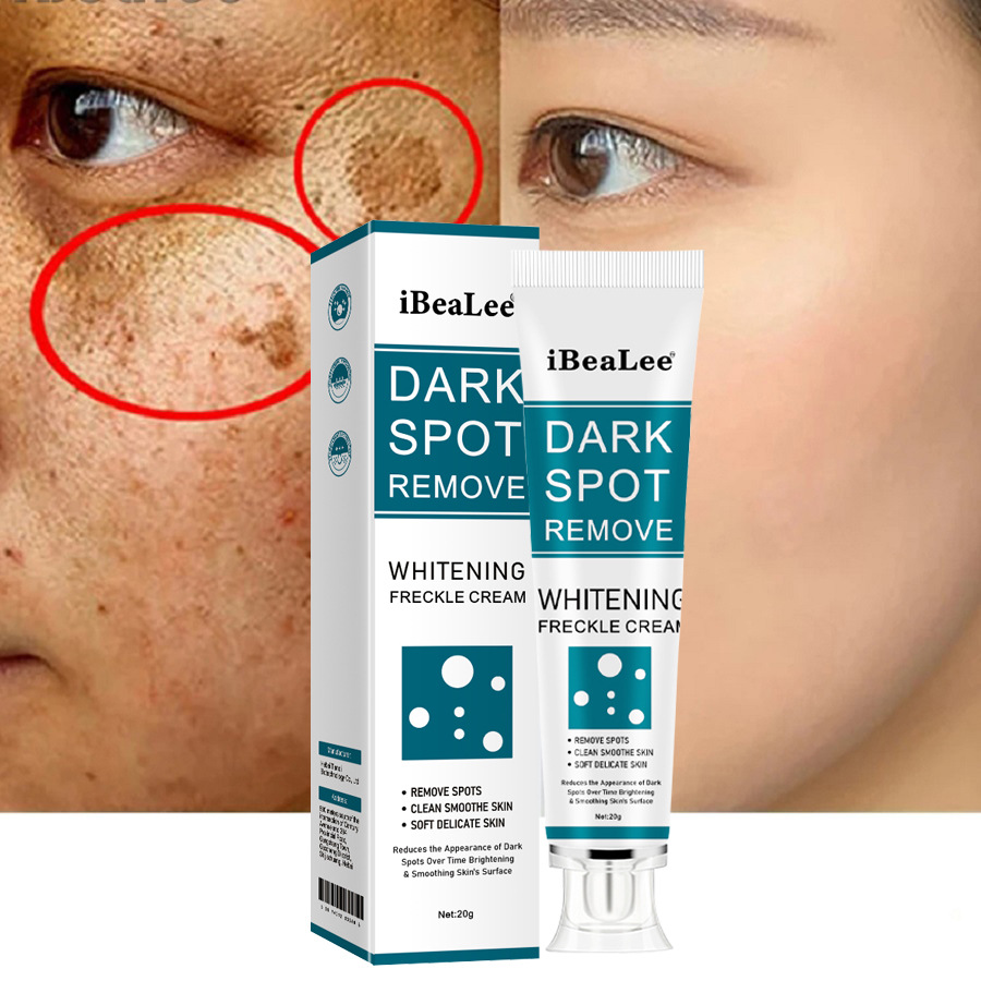 IBeaLee 미백 주근깨 제거 크림 페이드 컬러 스폿 온화한 주근깨 제거 노인성 스폿 melasma 수리 크림