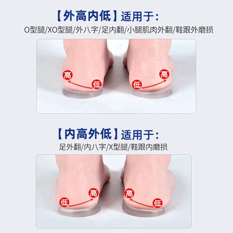 Transfronterizo silicona arco taconer almohadilla tipo o tipo X pantorrilla valgus ortopedia plantilla suave arco plano soporte plantilla