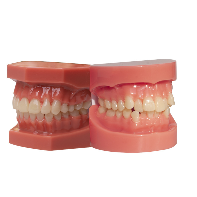 Modelo dental, modelo de corrección de demostración de mandíbula incorrecta, práctica de dentista, modelo de brackets pegajosos, molde de enseñanza de corrección