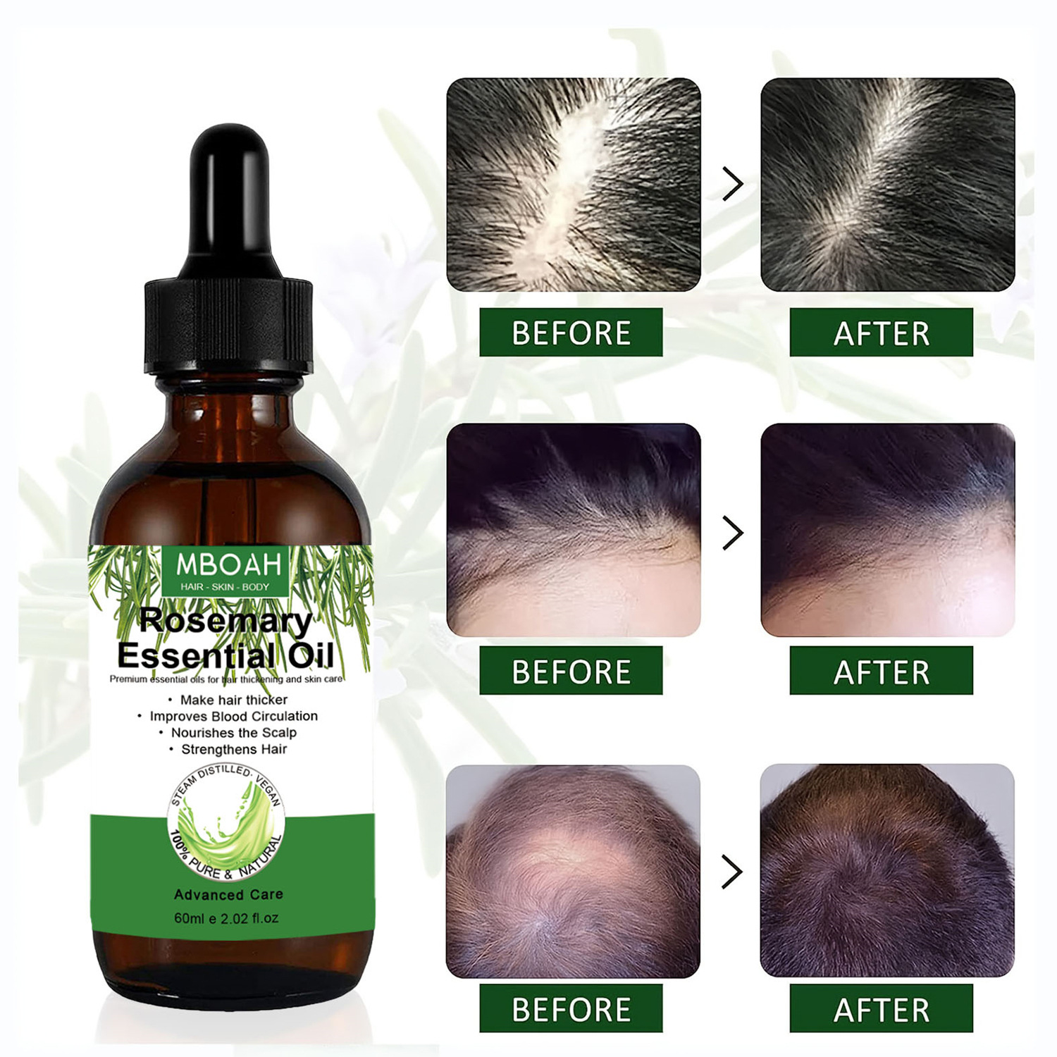 Rosemary Hair Oil Image 5