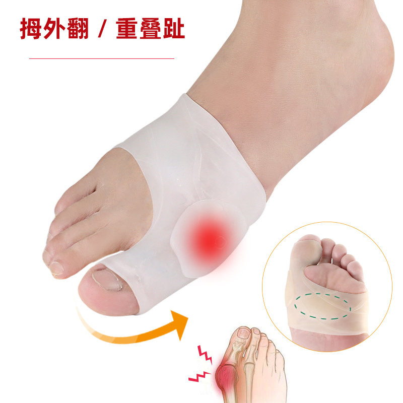 Big toe overlapping toe splitter orthosis Hallux valgus separator Big toe toe orthosis Toe splitter