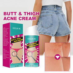 EELHOE 臀部大腿淨痘霜 淡化身體背部臀部大腿痘痘清潔護理肌膚