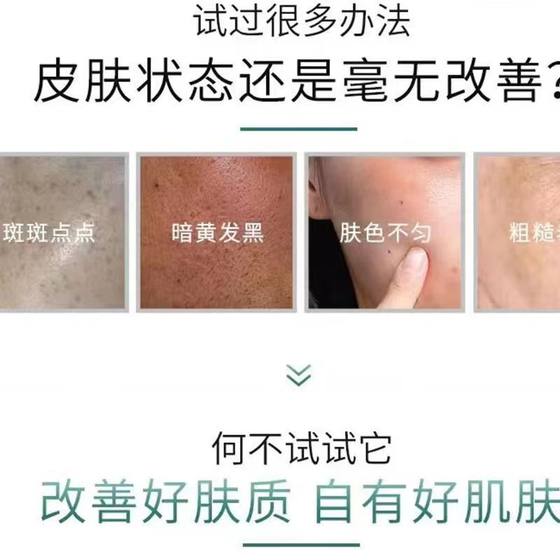 Beauty salon set box blue diamond skin rejuvenation sponge bone needle 8D hard collagen cream ice needle acne acne marks closed shrink pores