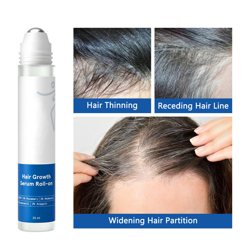 国境を越えた売れ筋ローズマリー育毛血清ヘアローラーエッセンス 25 ミリリットルマイルドなヘアケア|undefined