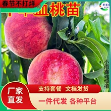 һ�����l���AѪ�����ش�������޽��Ҙ���ˮ�����������ϱ����Nֲ