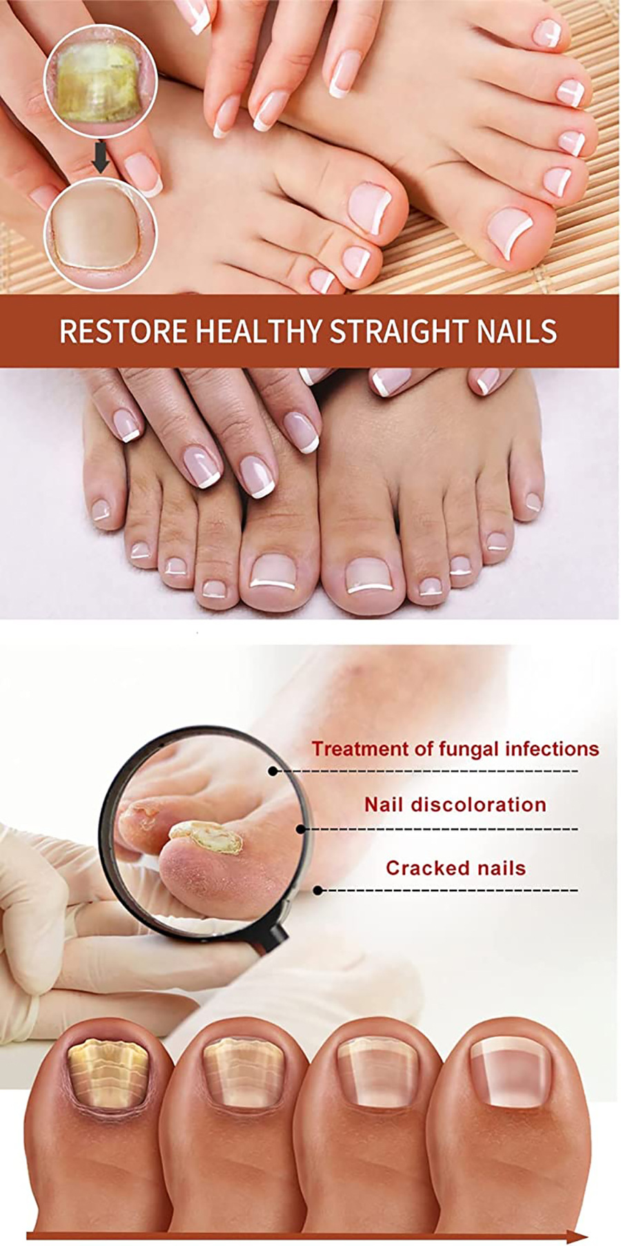 Crema desmaquillante antibacteriana especial para uñas, espesante para uñas suaves, y solución especial para uñas grises s,s_voghion.com