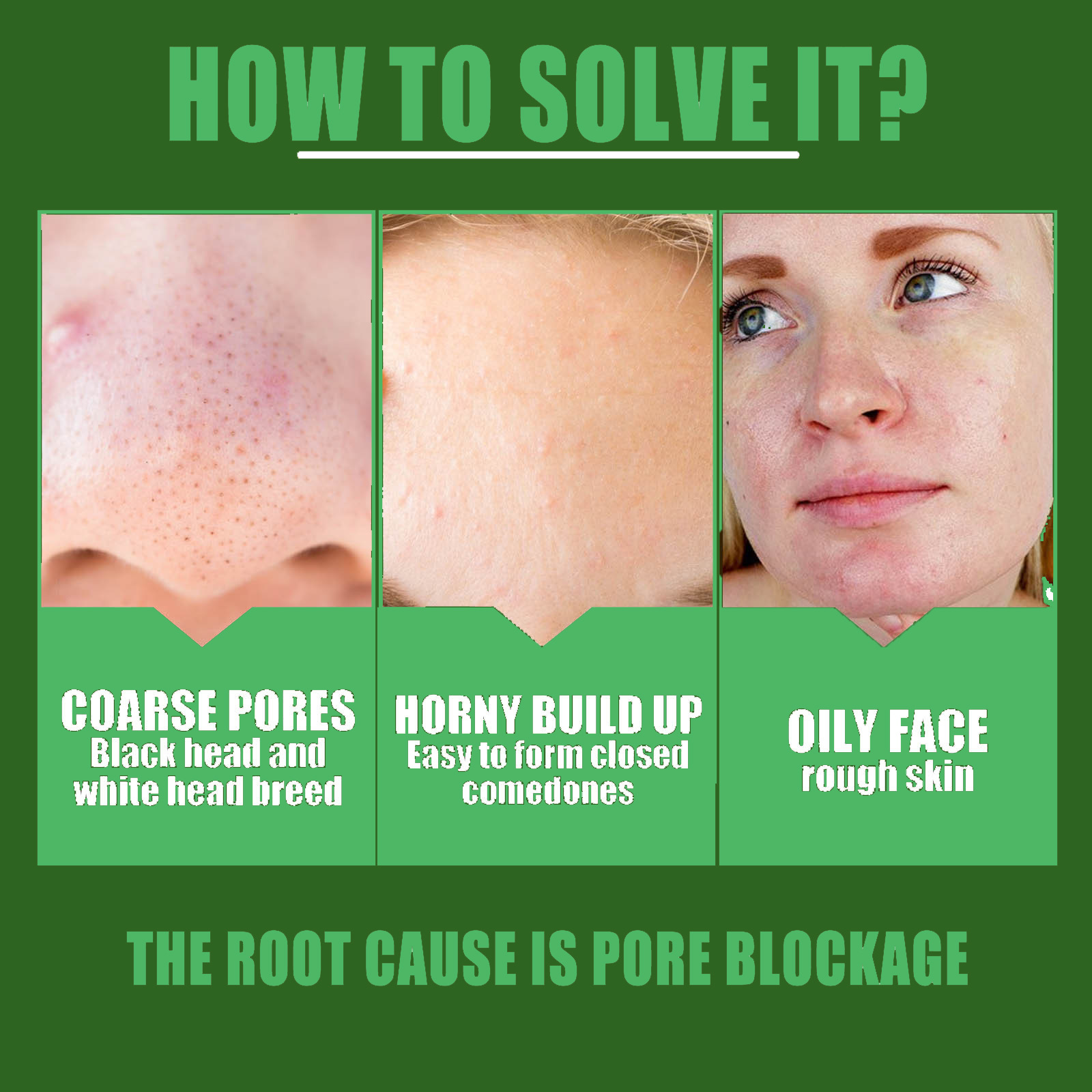 EELHOE Green Tea Pore Shrinking essence Solution Moisturizes, moisturizes, gently shrinks, refines pores, revitalizes_voghion.com