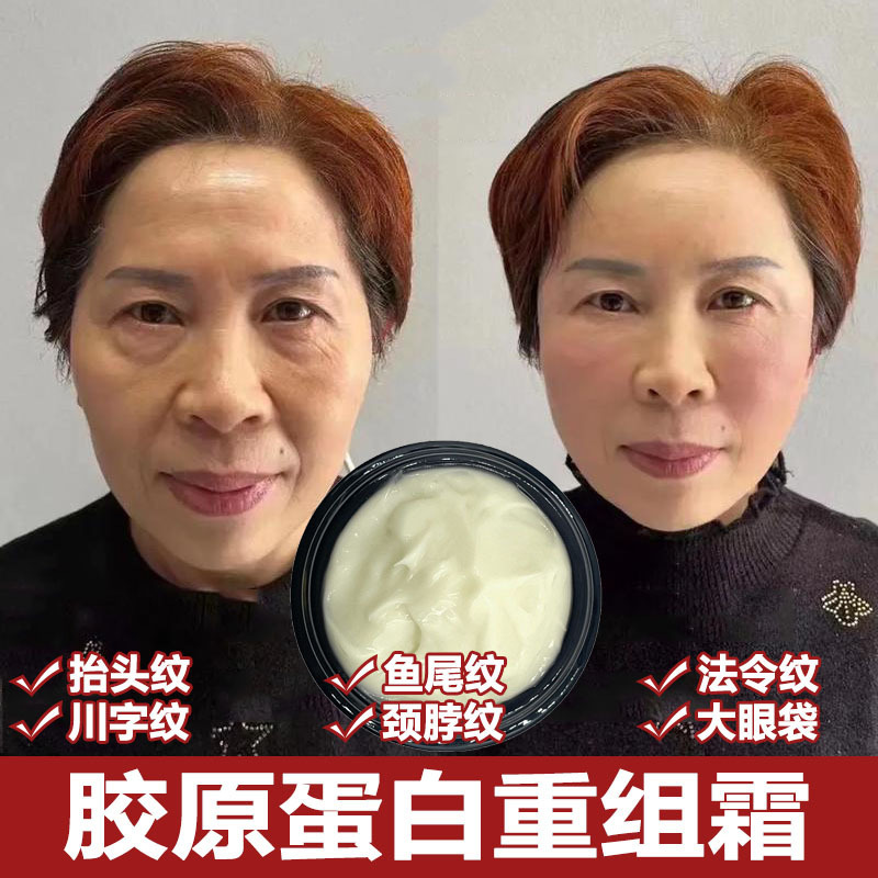 胶原蛋白重组霜去皱紧致霜逆龄精华液保湿去抬头纹法令纹淡化细纹|undefined