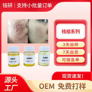 ��Ч�ݱ��˪��ˮҺ���A�]�ڷ۴���Ƥ����ˮ���ữ�yƷ���S