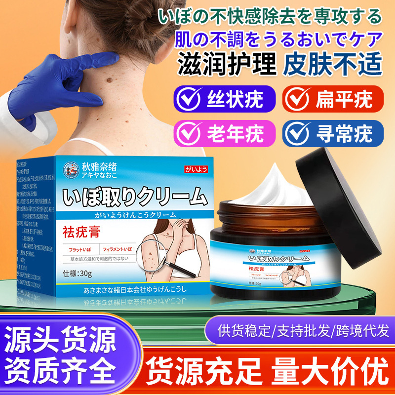 Qiuyanaiwu Wart Removal Cream 30g Is Used for External Application on Skin, Cervical Granules, Flat Warts, Small Black Warts, and External Use Qiuyanaiwu Wart Removal Cream 30g Is Used for External Application on Skin, Cervical Granules, Flat Warts, Small Black Warts, and External Use