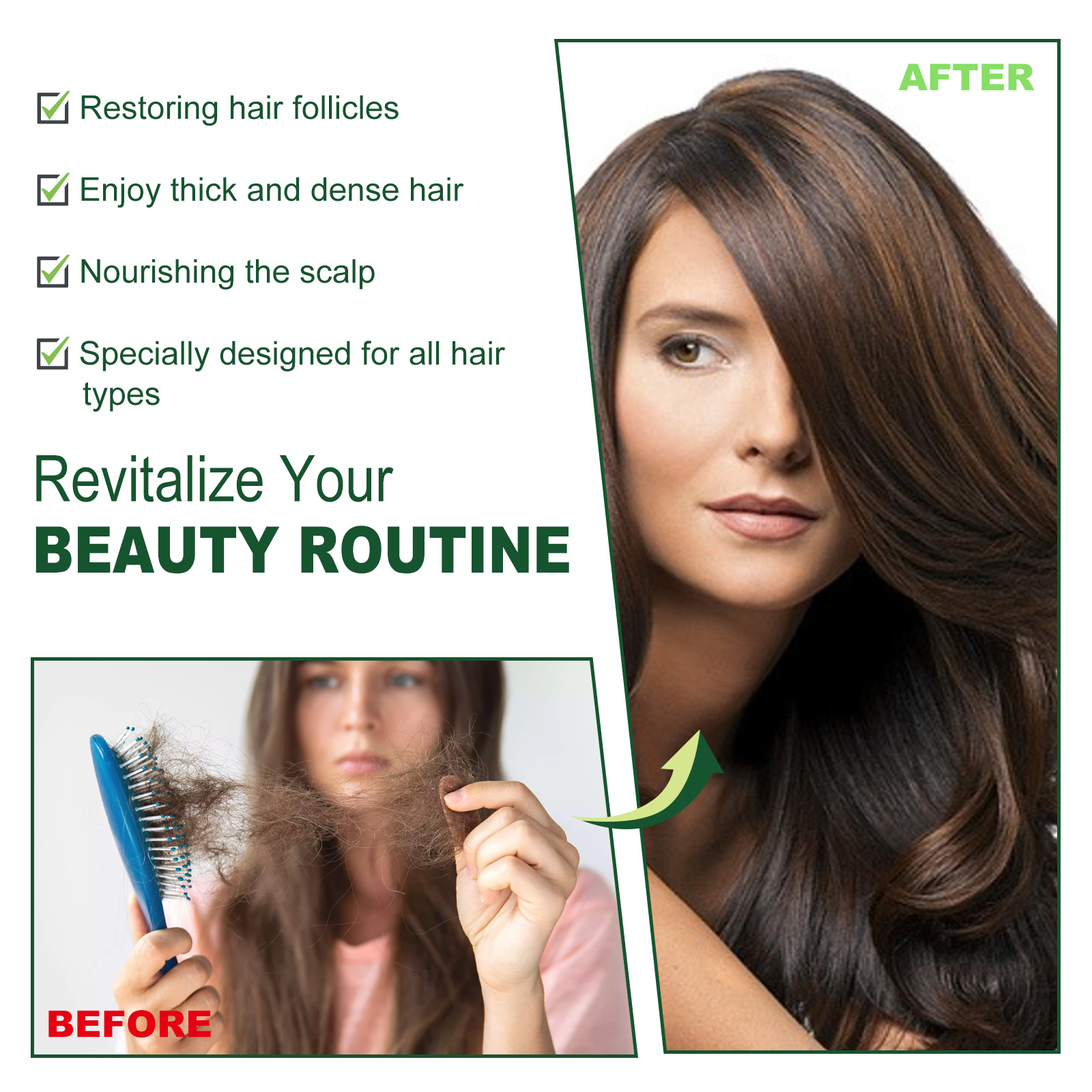 Das ätherische Rosmarin-Haaröl von EELHOE pflegt die Kopfhaut, beugt Haarausfall vor, verdichtet, spendet Feuchtigkeit und stärkt die Haarpflege_voghion.com