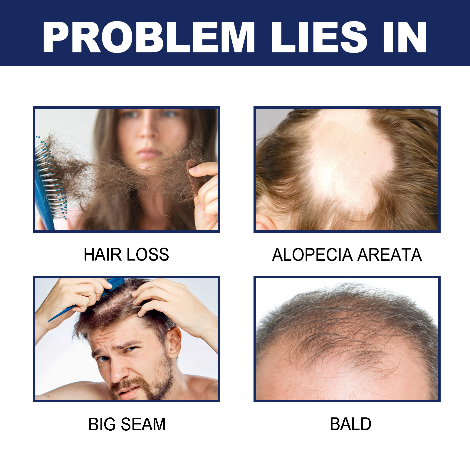 Aceite esencial de cuidado de hierbas EELHOE para el cuidado, cabello fuerte y firme, prevención de la caída, reparación del cabello denso y_voghion.com