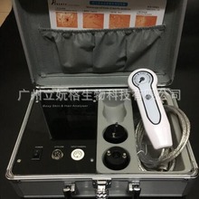 接电脑USB皮肤测试仪高清美容定格头发检测仪毛发皮肤发质检测