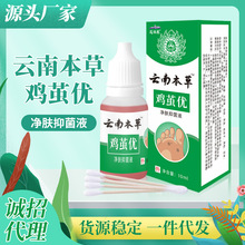 供应巡洋舰鸡茧优去鸡眼老茧瘊子跖疣足部护理滴液代加工一件批发