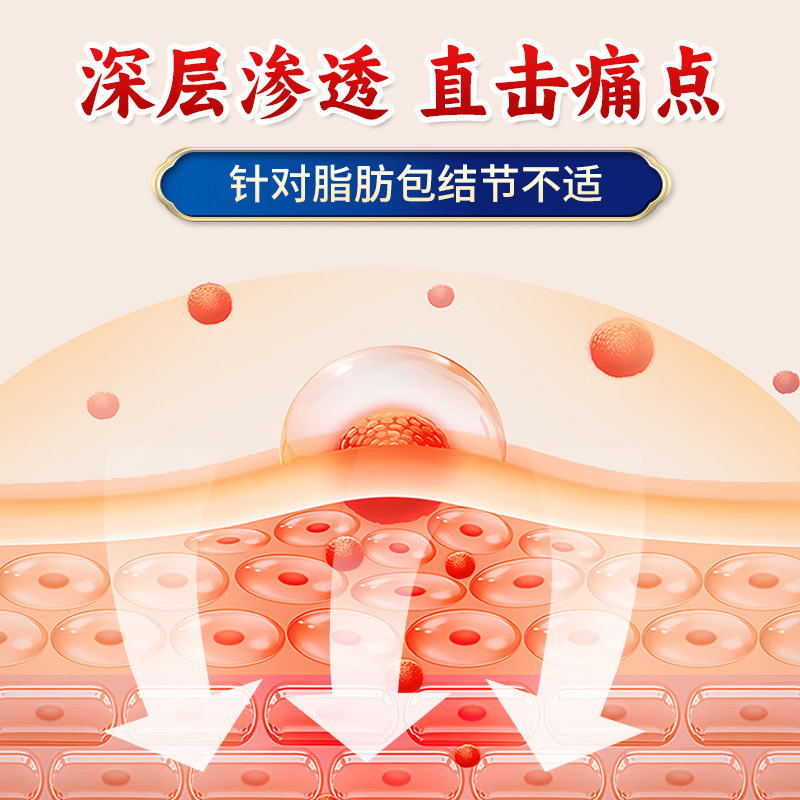 脂肪包膏缓解脂肪包块皮下硬块外用护理膏结节富贵包肿大涂抹膏|undefined