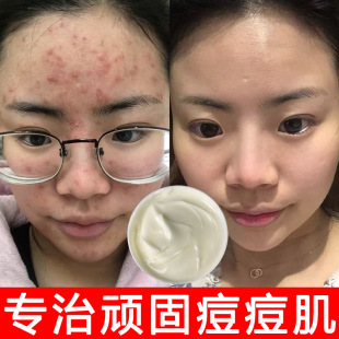 Ժ���ݱ���൭����ӡȥ�ഺ�����^�۴̸����]�����o�����˪