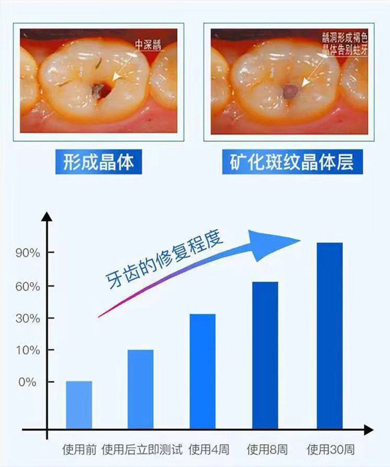 【香港大药房*再生硅护龈固龄防蛀去牙结石抗牙敏感牙膏正品-阿里巴巴