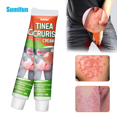 sumifun跨境外貿亞馬遜腹股肛周皮膚紅斑皮膚廯股溝癬膏K10128