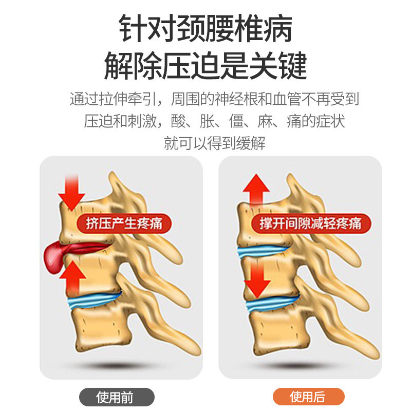 永輝多機能家庭用腰椎牽引ベッド腰椎椎間板牽引器治療器全自動頚椎ストレッチ|undefined