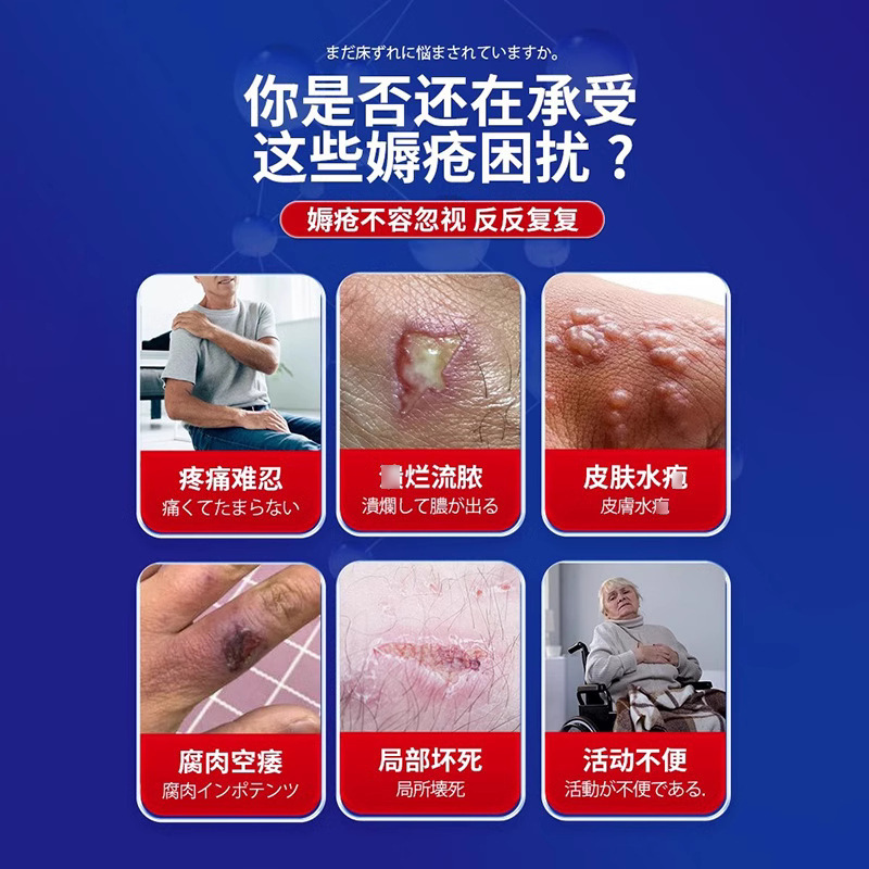 岩井弘褥瘡クリームは足のお尻の外用腐老人が麻痺しています。|undefined