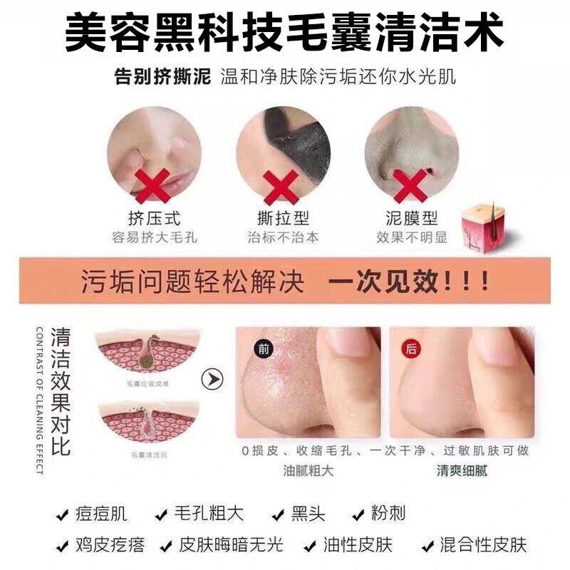 美容院毛包洗浄クリーム毛穴洗浄術黒頭除去閉口角質深層洗浄顔マッサージクリーム|undefined